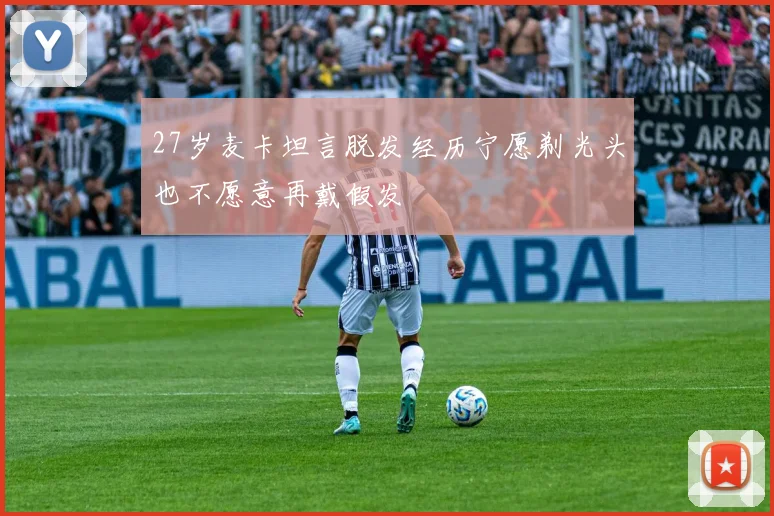 27岁麦卡坦言脱发经历宁愿剃光头也不愿意再戴假发